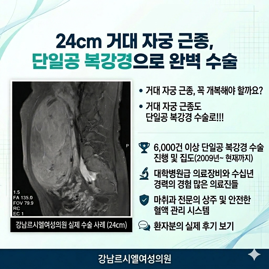 24cm 거대 자궁 근종 단일공 복강경 수술 사례